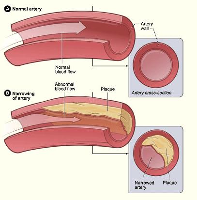Cholesterol and Wine A Good Deal